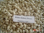 white kidney beans Japanese type